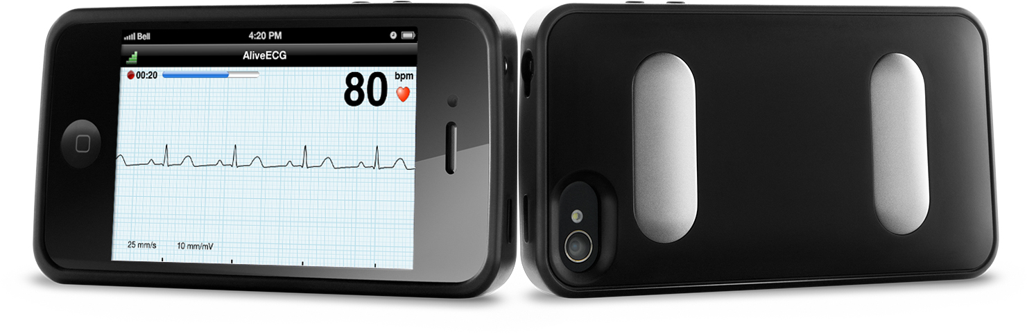 AliveCor ECG